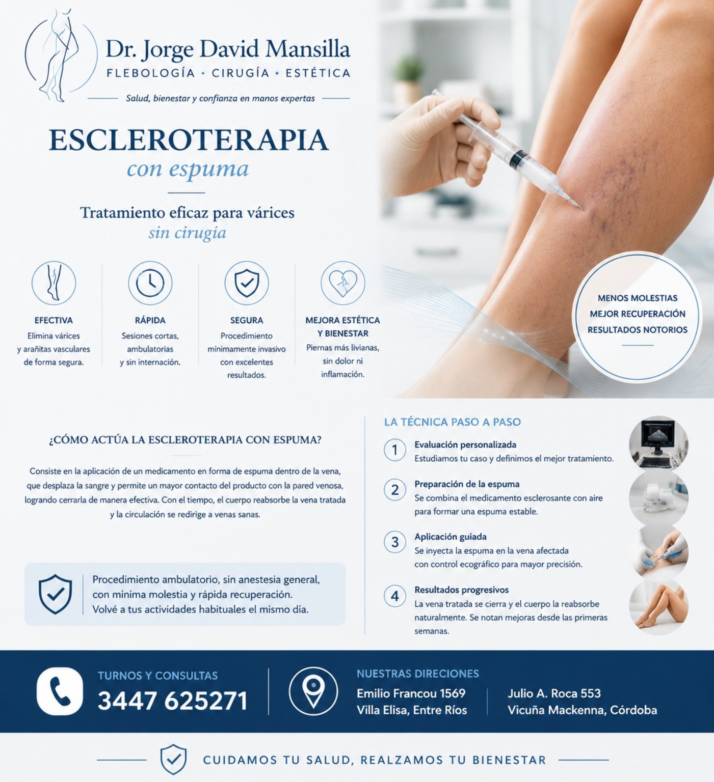 Escleroterapia con espuma