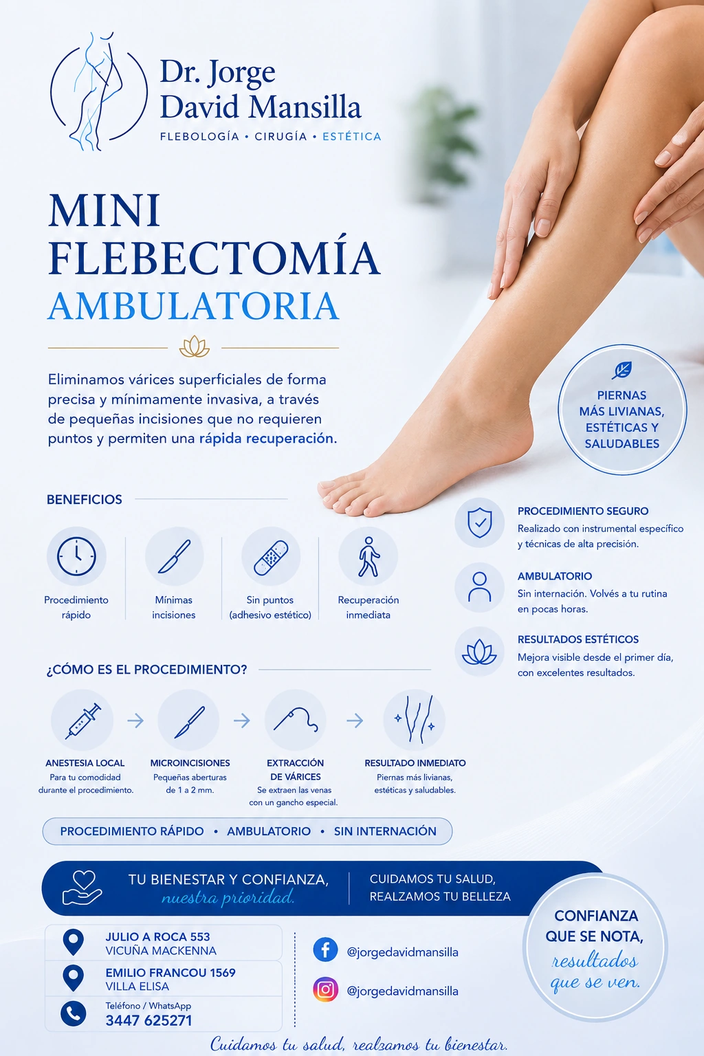 Mini flebectomía ambulatoria