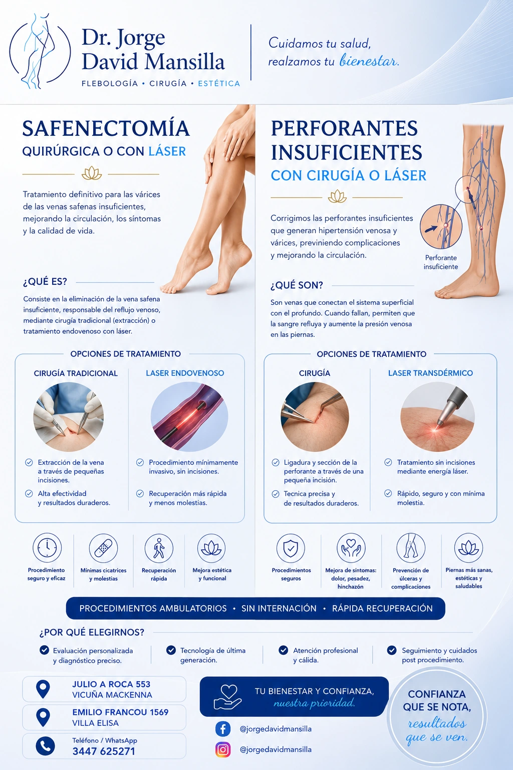 Safenectomía y tratamiento de perforantes insuficientes con cirugía o láser